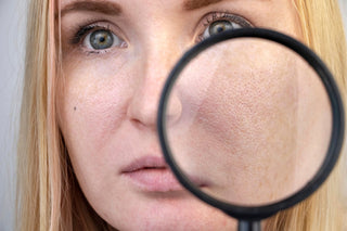 Debunking the Myth: “Oily Skin Doesn’t Need Moisturizer”