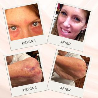 before and after images