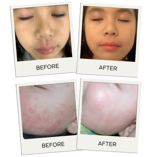 before and after images