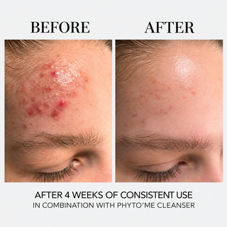 AZURIEN Clarifying Beauty Renewal Essence for oily and blemish prone skin