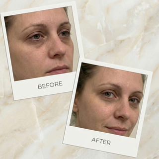 ILIGHT Organic Advanced Brightening & Line Smoothing Eye Treatment