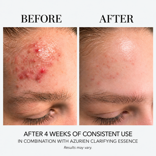 PHYTO'ME Cleansing Nectar & Masque with Fruit Enzymes and Salicylic acid