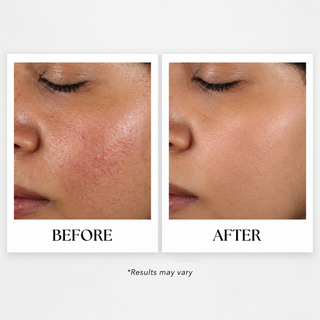 SELENIYA Nourishing Skin Barrier Concentrate, with Ceramide, Peptide, Microalgae, Selenium, 1oz