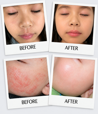  before and after images of a young child and baby after using the product