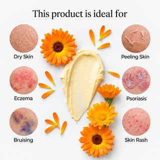 image highlighting various skin conditions which this cream is perfect for. Surrounded by cream swatch and calendula flowers