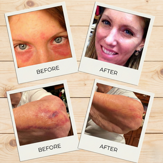 CALENDULA Organic Butter Cream, with Manuka, Arnica & Helichrysum.