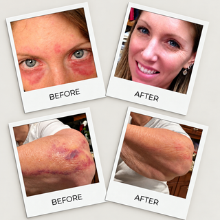 before and after images of people after using calendula butter cream