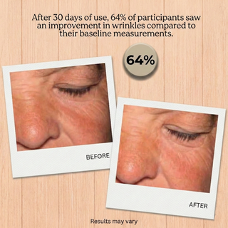 GENELYSSE Advanced Lifting and Firming Night Recovery Complex, with Matrixyl 3000, Retinol and Plant Stem Cells