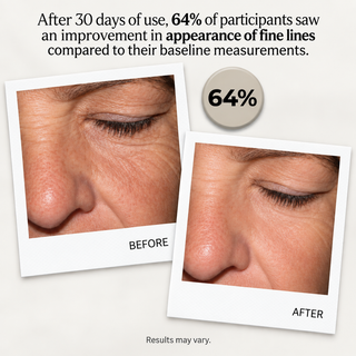 GENELYSSE Advanced Lifting and Firming Night Recovery Complex, with Matrixyl 3000, Retinol and Plant Stem Cells