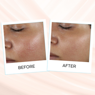 photos of before ans after of using Seleniya