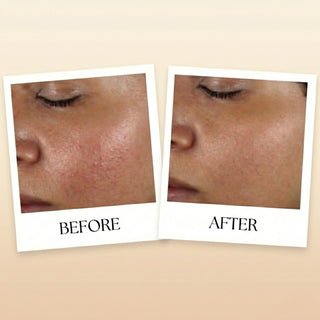 SELENIYA Nourishing Skin Barrier Concentrate, with Ceramide, Peptide, Microalgae, Selenium, 1oz